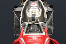 AXP RACING Honda AX1598 Radiator Braces - Enhanced Protection and Secure Fit